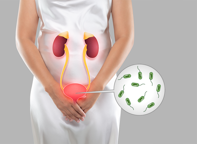 Urinary Tract Infection Symptoms – Burning Sensation And Frequency