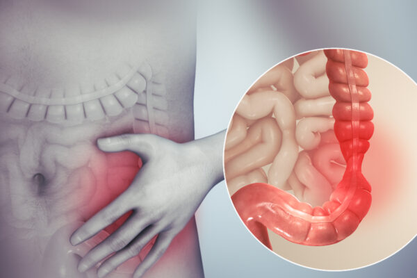 IBS Symptoms – Gut Problems Doctors Often Miss