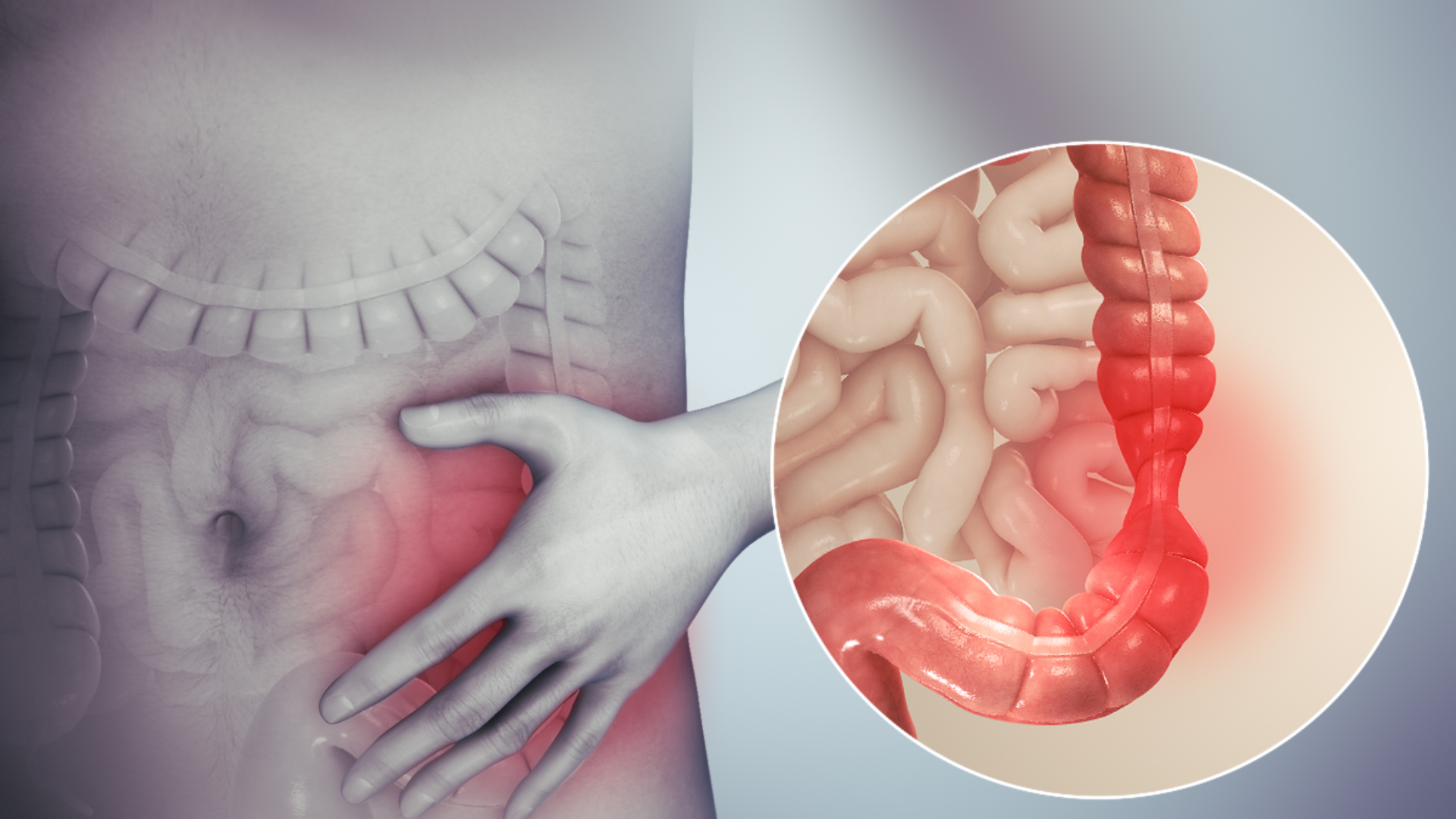 IBS Symptoms – Gut Problems Doctors Often Miss