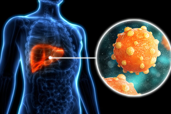 Hepatitis B Symptoms – Liver Damage Signs Appearing Early