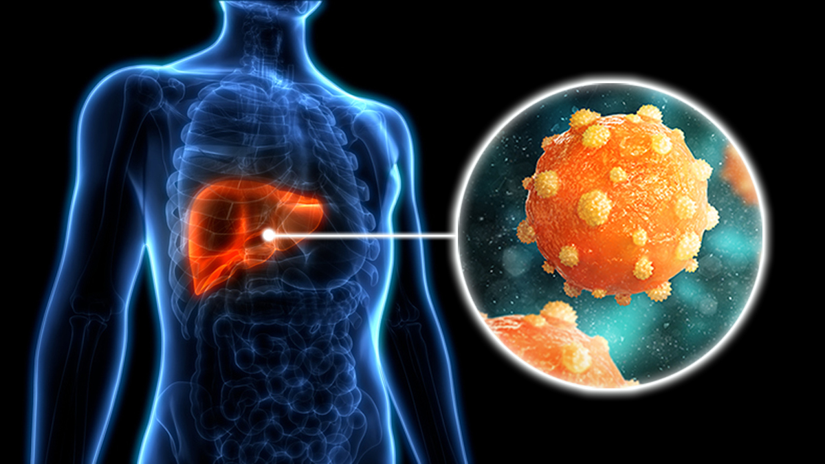 Hepatitis B Symptoms – Liver Damage Signs Appearing Early
